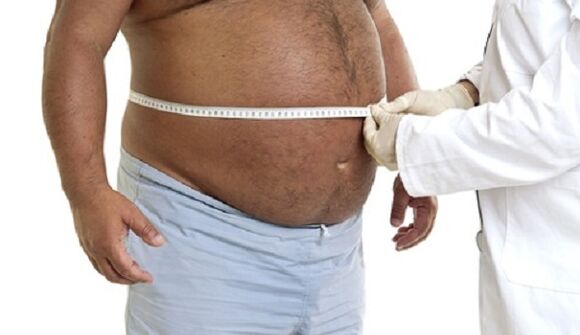 lekár určí spôsob chudnutia u obézneho muža